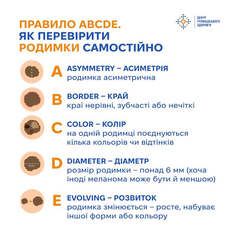 Як запобігти меланомі