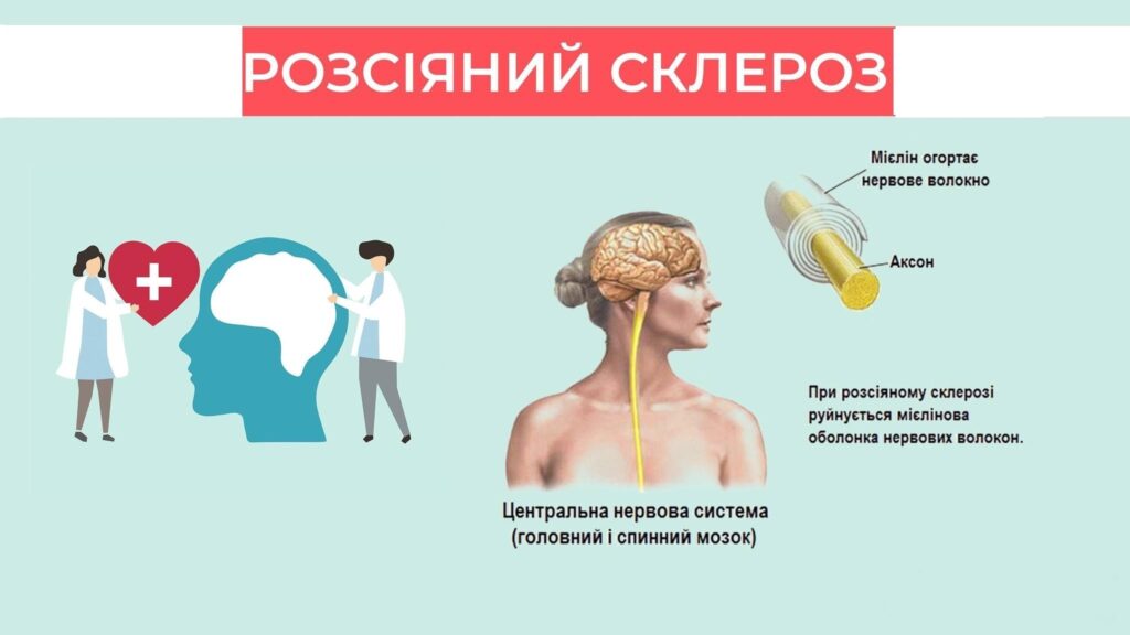 Всесвітній день розсіяного склерозу