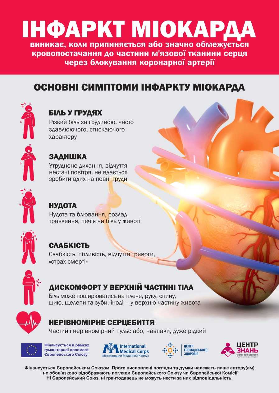 Інфаркт міокарда