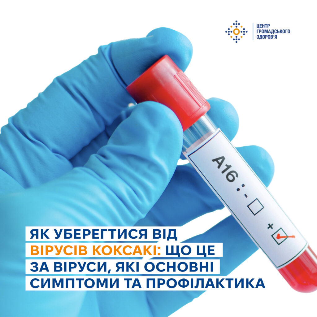 Віруси Коксакі