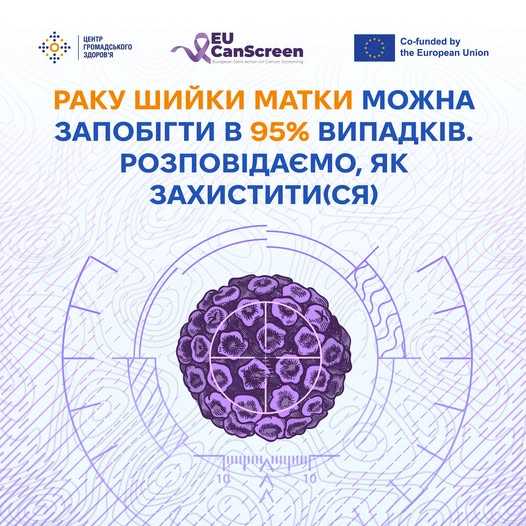 Рак шийки матки