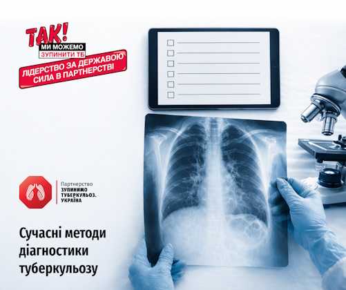 Як виявляють туберкульоз: сучасні методи діагностики