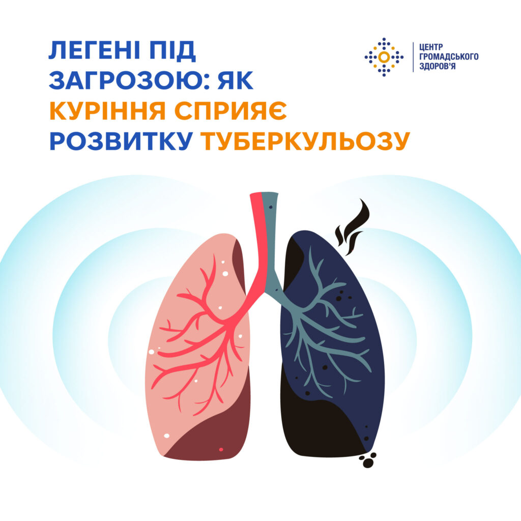 Легені під загрозою: як куріння сприяє розвитку туберкульозу